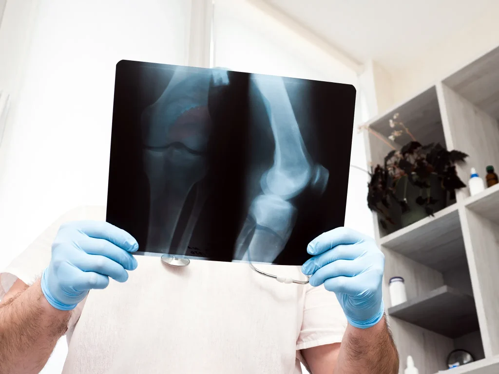 radiologia simple